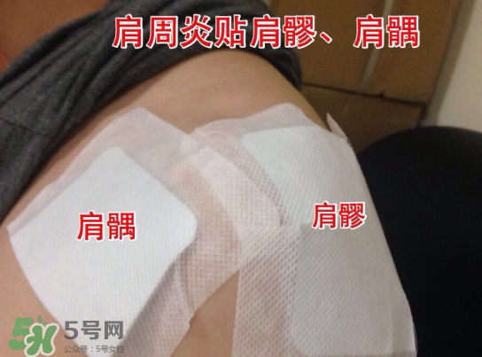 艾灸貼多少錢一盒?？艾灸貼一盒60裝多少錢？