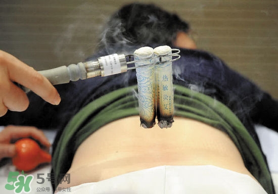 艾灸多少錢一次？艾灸調(diào)理價(jià)目表