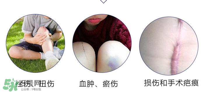 hirudoid除疤膏有效嗎？hirudoid去疤膏效果如何？