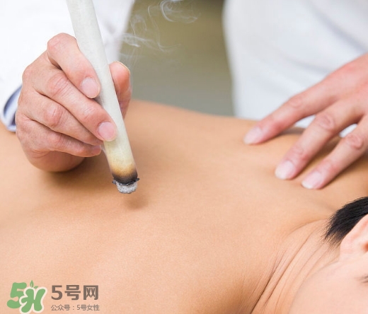 三伏貼和艾灸哪個好？三伏貼和艾灸區(qū)別