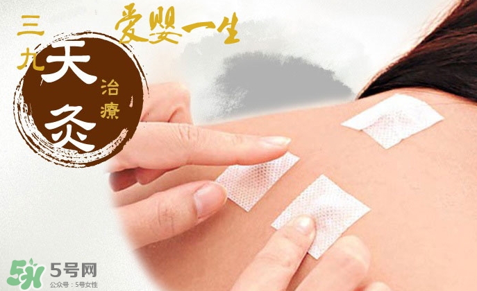 貼三伏貼可以吃魚嗎？貼三伏貼可以吃什么魚？