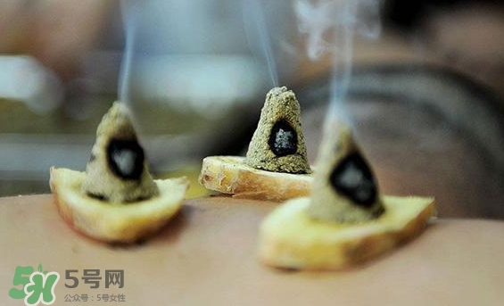 貼三伏貼可以艾灸嗎？貼三伏貼多久可以艾灸