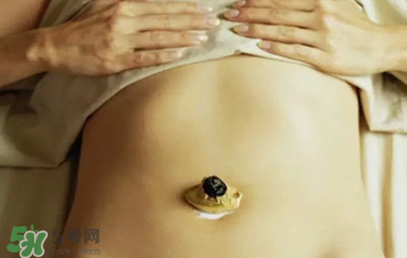 艾灸貼可以貼肚臍眼嗎？艾灸貼貼肚臍的功效