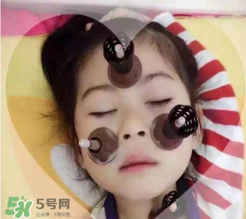 艾灸貼可以治咳嗽嗎？艾灸貼可以治退燒嗎？