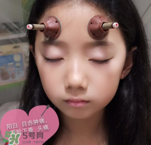 艾灸貼可以治咳嗽嗎？艾灸貼可以治退燒嗎？