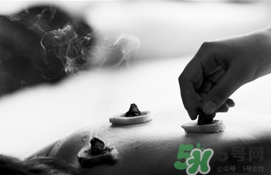 三伏灸什么時候開始灸？三伏灸怎么灸？