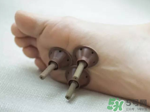 艾艾貼灸出水珠為什么？艾艾貼后有水珠要擦嗎？