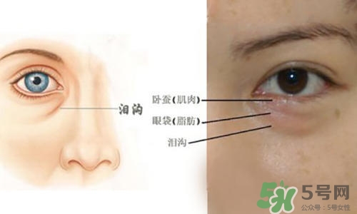 淚溝能自己恢復(fù)嗎？淚溝怎么自己恢復(fù)？