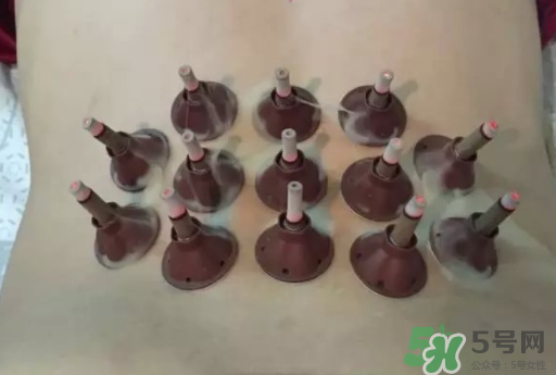 艾艾貼可以貼肚臍眼嗎？艾艾貼貼肚臍有什么作用？