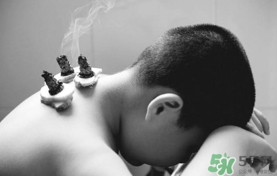 三伏灸要灸幾次？三伏灸要灸多久？