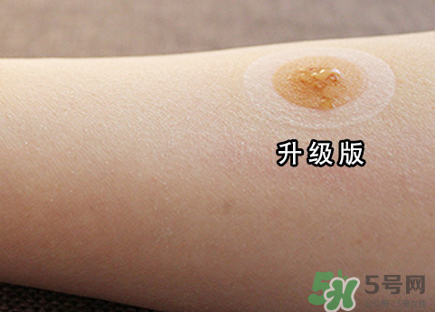 艾灸貼后有水泡怎么辦？貼艾灸貼應(yīng)注意些什么？