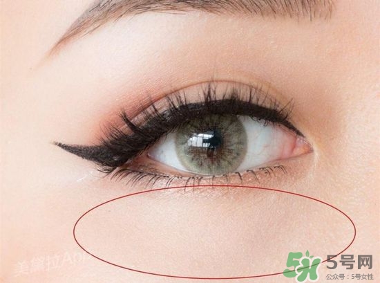 玻尿酸填充淚溝多久恢復(fù)自然？玻尿酸填充淚溝的危害