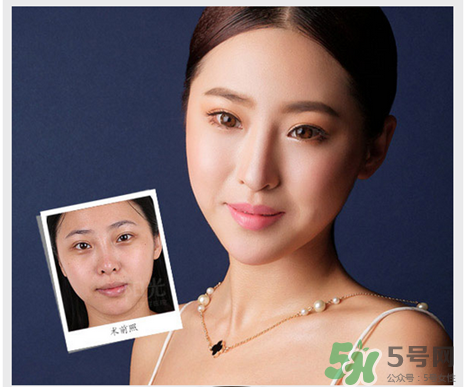 填充淚溝有風(fēng)險(xiǎn)嗎？填充淚溝的方法