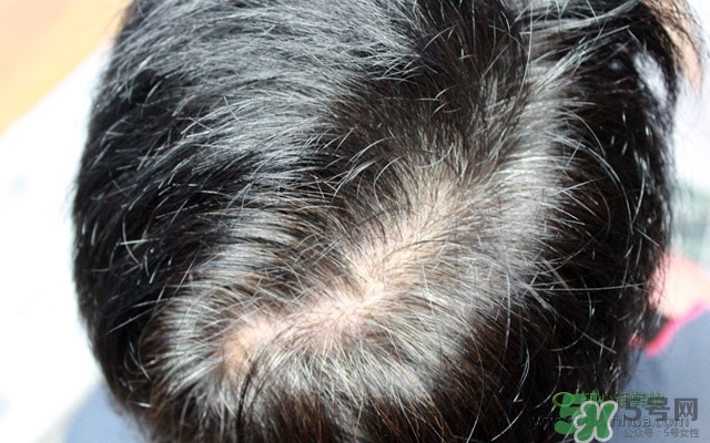 呂染發(fā)膏染發(fā)劑使用方法 呂染發(fā)膏使用方法圖解 呂染發(fā)膏染發(fā)劑使用方法 呂染發(fā)膏使用方法圖解