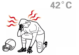 熱射病為什么不能喝水？熱射病為什么會抽搐