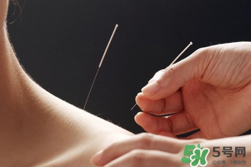 針灸能治療哪些??？古代針灸用具是幾針