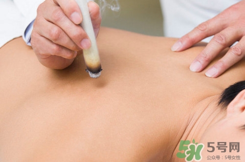 三伏灸一次做多長(zhǎng)時(shí)間？三伏灸用新生姜好還是老的好