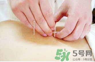 放血療法治中風(fēng)靠譜嗎？放血療法主要針對什么樣的病