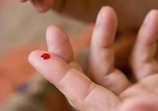 放血療法能治濕氣重嗎？放血療法治病的原理是什么