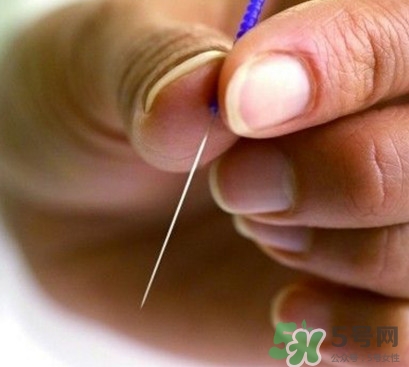 放血療法能治濕氣重嗎？放血療法治病的原理是什么