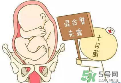 胎位不正能順產(chǎn)嗎？胎位不正怎么辦？