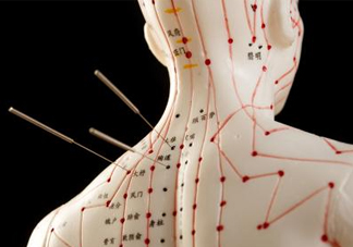 針灸可以自己扎嗎？針灸可以減肥嗎
