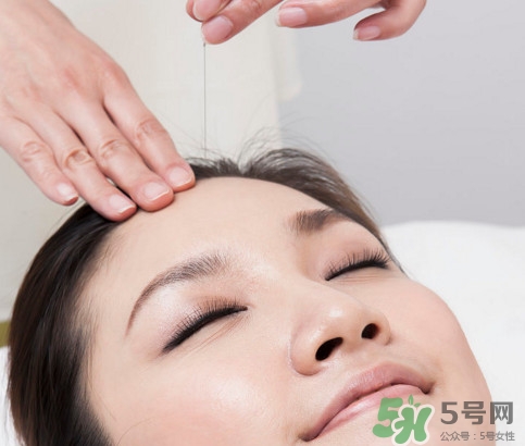 中醫(yī)院針灸一次多少錢？針灸后疼痛加重正常嗎