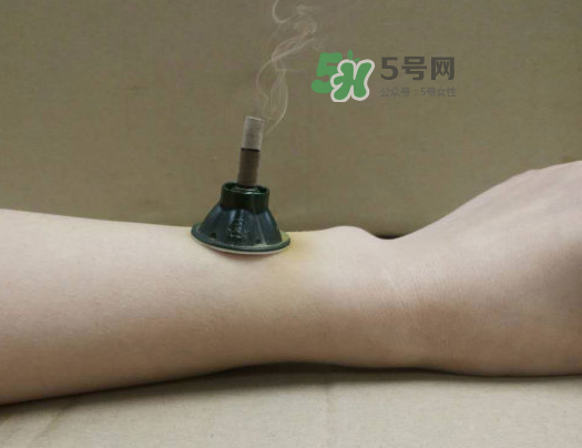 三伏天下雨可以艾灸嗎？三伏天下雨艾灸好嗎？