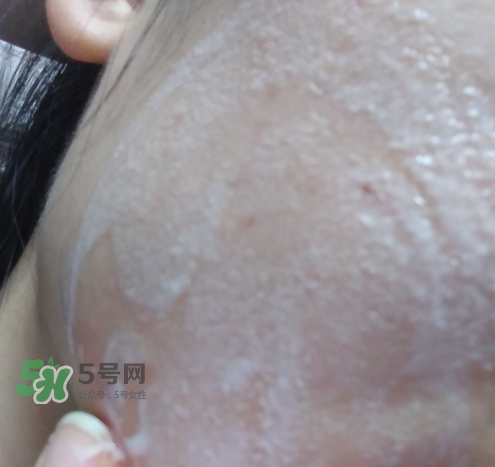 貝蜜清凈痘控油潔面啫喱怎么樣？貝蜜清祛痘控油潔面啫喱好用嗎？