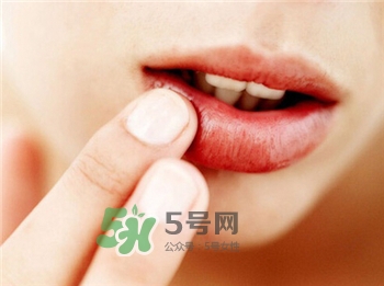 汗皰疹是什么?汗皰疹的治療 汗皰疹是什么?汗皰疹的治療