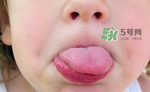 三伏天為什么濕氣重？三伏天為什么要注意祛濕？