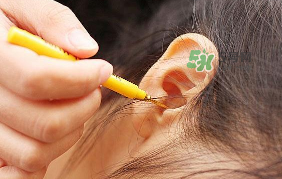 兒童耳屎成硬塊怎么辦？?jī)和撼捎矇K有危害嗎？