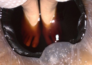 醋泡腳用白醋還是陳醋？泡腳用什么醋最好？