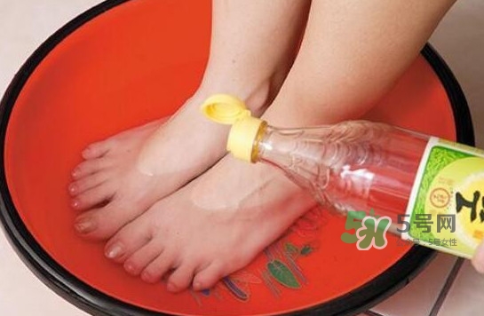 醋泡腳用白醋還是陳醋？泡腳用什么醋最好？