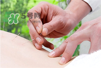 針灸減肥有副作用嗎?針灸減肥的作用 針灸減肥有副作用嗎?針灸減肥的作用