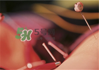 針灸減肥有副作用嗎?針灸減肥的作用 針灸減肥有副作用嗎?針灸減肥的作用