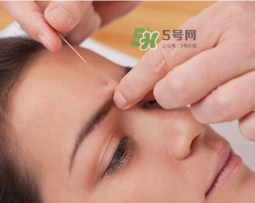 三伏天針灸有什么好處？三伏天針灸注意什么？