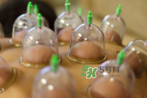 拔火罐是夏天好還是冬天好？什么時(shí)候拔火罐最合適？