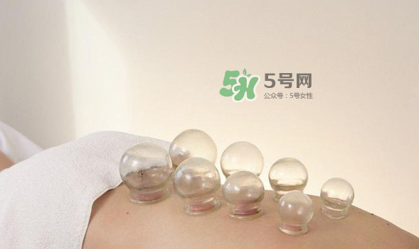 拔火罐是夏天好還是冬天好？什么時(shí)候拔火罐最合適？