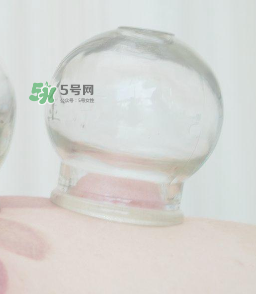 拔火罐一次多長(zhǎng)時(shí)間？拔火罐一般多長(zhǎng)時(shí)間？