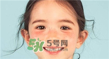 去眼袋選外切好還是內(nèi)切好?去眼袋手術(shù)利弊分析 去眼袋選外切好還是內(nèi)切好?去眼袋手術(shù)利弊分析