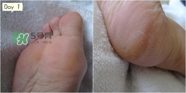 baby foot足膜怎么用？baby foot足膜使用方法