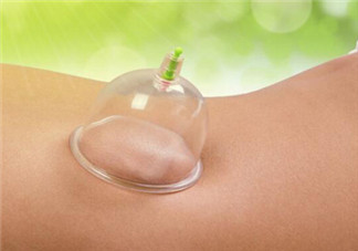 拔火罐是夏天好還是冬天好？什么時(shí)候拔火罐最合適？