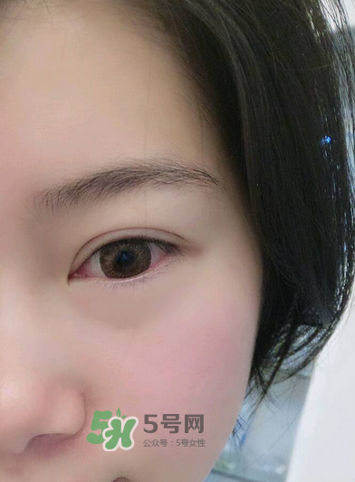 做美瞳線疼嗎？做美瞳線后要注意什么？