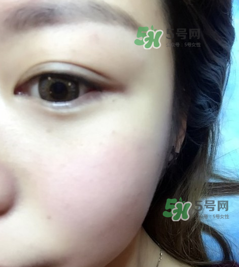 做美瞳線眼睛會腫嗎?做美瞳線眼睛腫了怎么辦? 做美瞳線眼睛會腫嗎?做美瞳線眼睛腫了怎么辦?