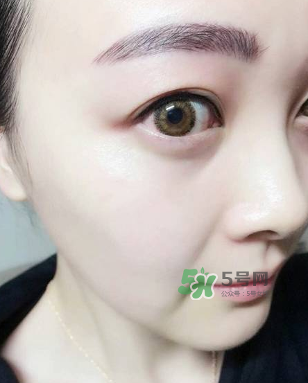 做美瞳線對眼睛有傷害嗎？做美瞳線會傷眼睛嗎？