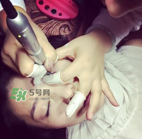 做美瞳線要打麻藥嗎？做美瞳線麻藥怎么敷？