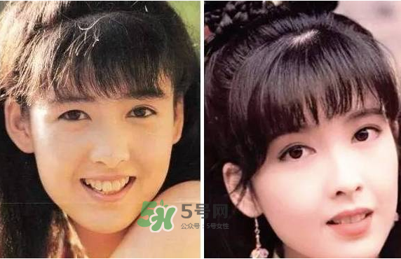 8月份可以割雙眼皮嗎？幾月份割雙眼皮最好？