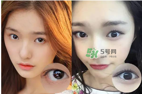 做美瞳線會(huì)不會(huì)掉睫毛？做美瞳線掉睫毛怎么辦？