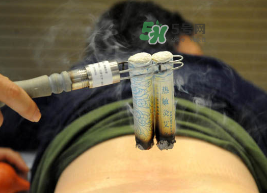 三伏天艾灸后能吹空調嗎？三伏天艾灸后能吹電扇嗎？